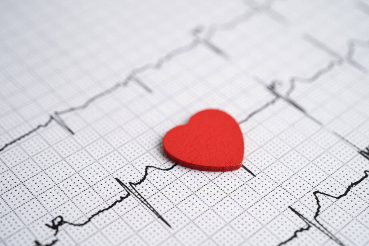Foods for Arrhythmia
