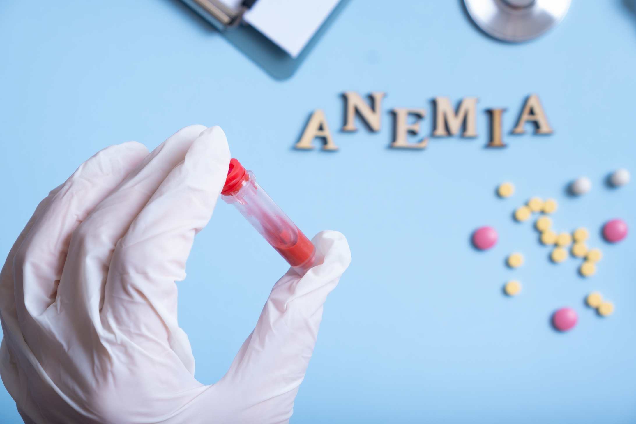 Megaloblastic Anemia: How It Affects Your Body and What You Can Do