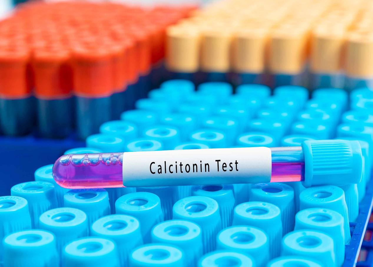 Calcitonin – Normal Values in Women and Men and What You Need to Know About This Hormone