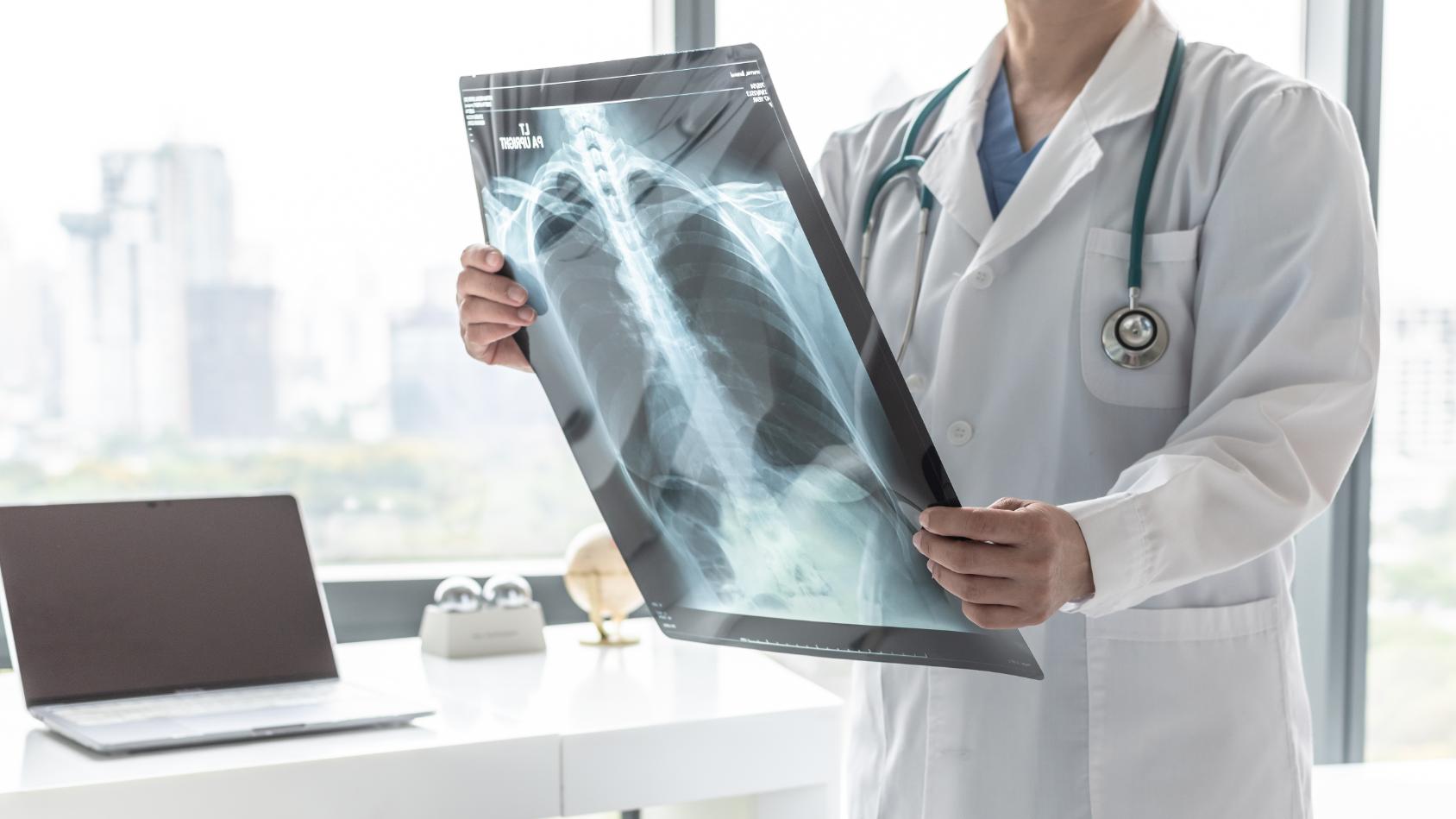 Pulmonary Emphysema – Trigger Mechanisms, Clinical Manifestations, and Management Options