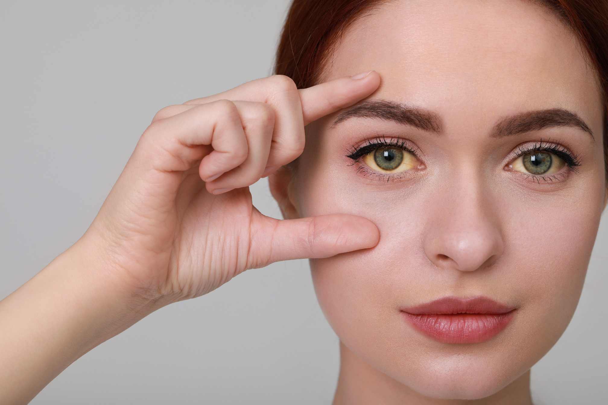 Jaundice: What This Yellowing of the Skin and Eyes Means and What It Says About Our Health