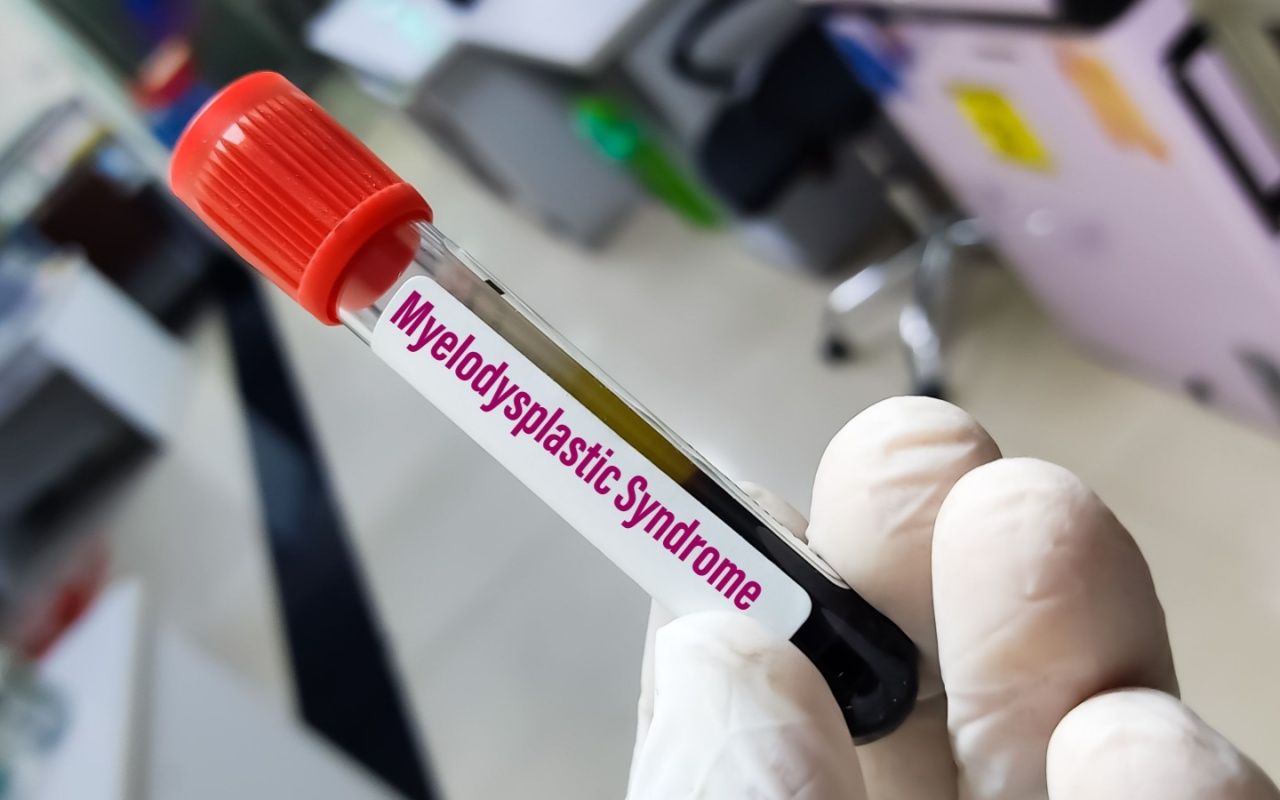 Myelodysplastic Syndromes – Causes, Symptoms, and Treatment Options